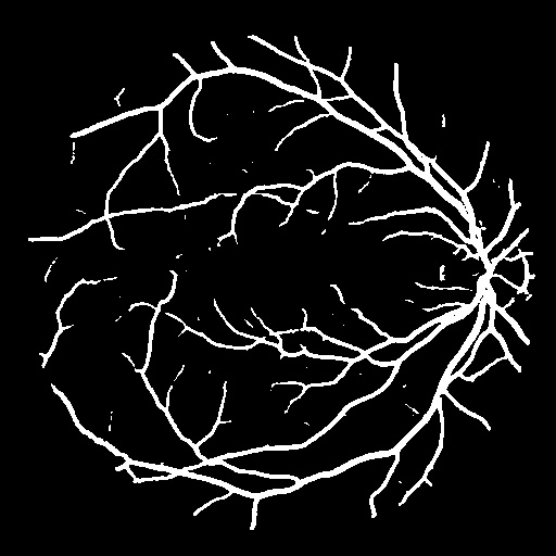 FR-UNet
