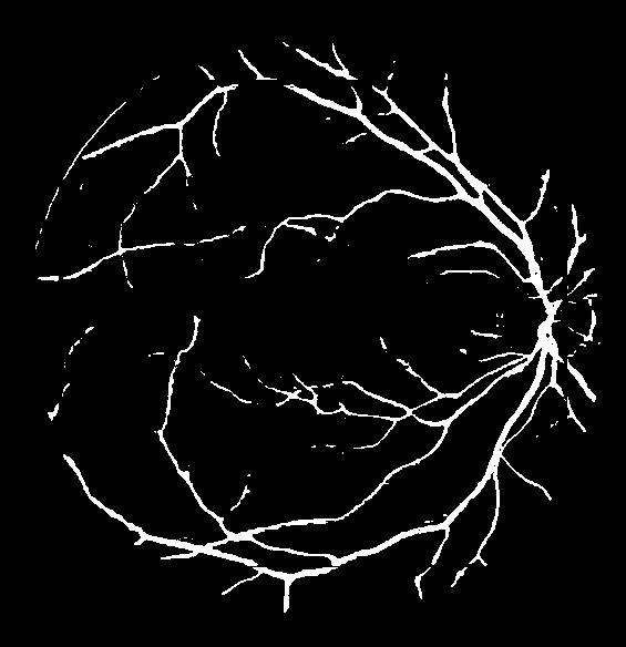SegDiff